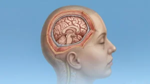 Cranial and brain surgery